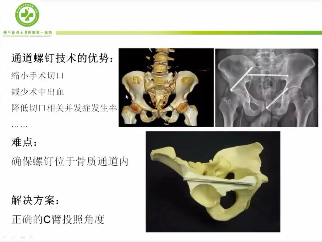 聚焦顯微外科|葫蘆島市醫(yī)學會顯微外科學分會第一屆第二次學術(shù)會議順利召開(圖11)